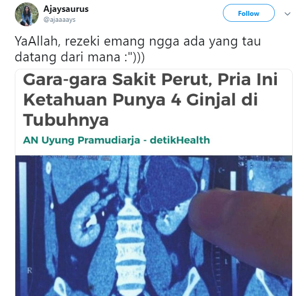 Begini Respons Mengejutkan Warganet Tentang Orang dengan 4 Ginjal